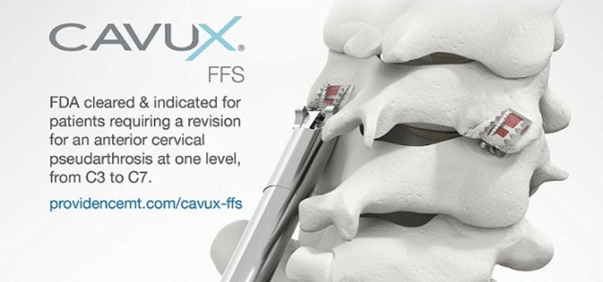FDA Clearance of CORUS™ Navigation Access System