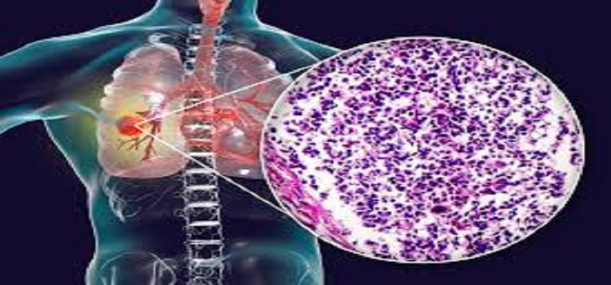 Biostar Pharma Secures FDA Approval for Phase 2 Trial of Utidelone Injection (UTD1)