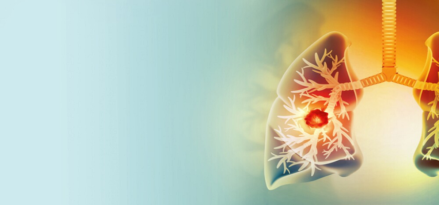 XellSmart Gets FDA OK for 3 iPSC Ce..