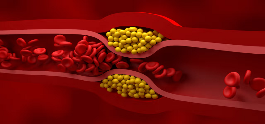 Merck’s Oral PCSK9 Inhibitor Shows..