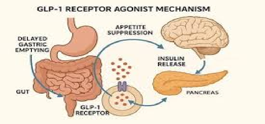 GLP-1 Receptor Agonists Linked to Reduced Asthma Exacerbat..