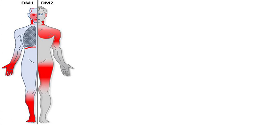 The New England Journal of Medicine Publishes Results from..