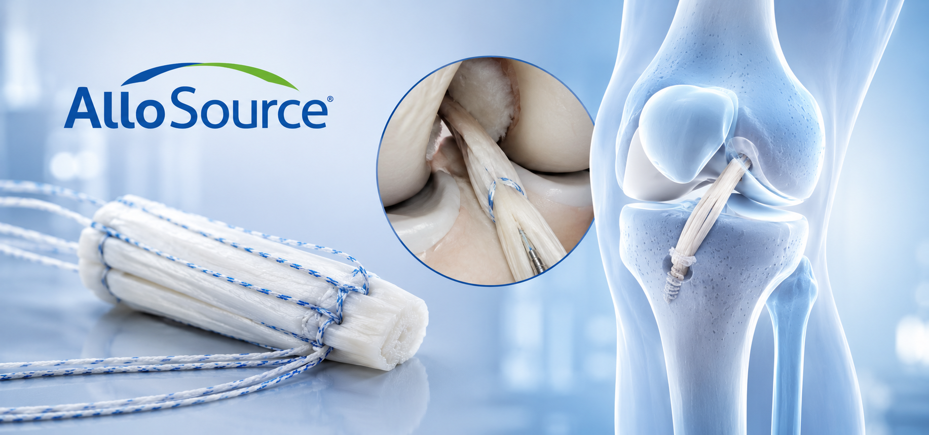 AlloSource Launches ReConnex Pre-Su..